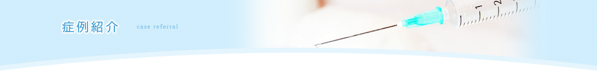 症例紹介